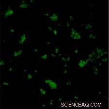 Glow Stick Technology Advances: A Novel Cancer Detection Probe