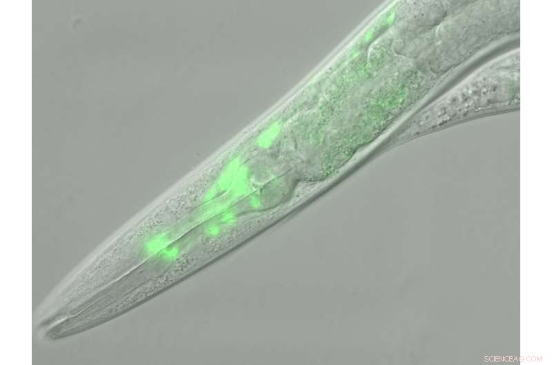 Unlocking Human Growth: Lessons from the Tiny Worm C. elegans
