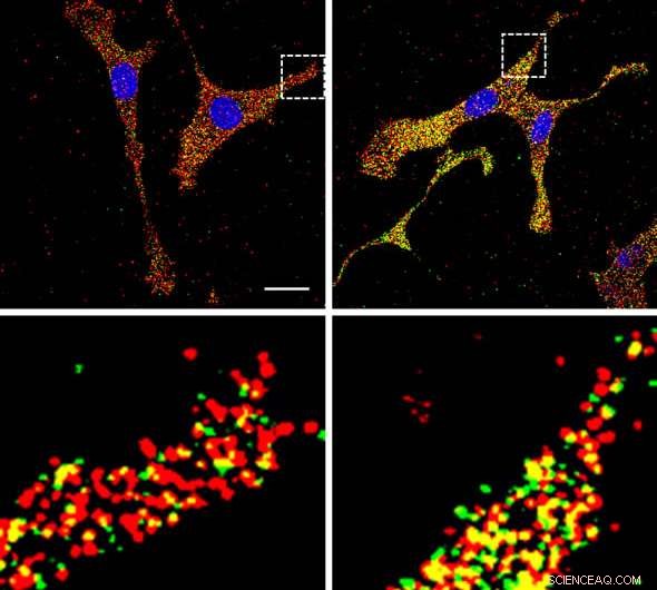 Real-Time Imaging of mRNA at Its Translation Sites