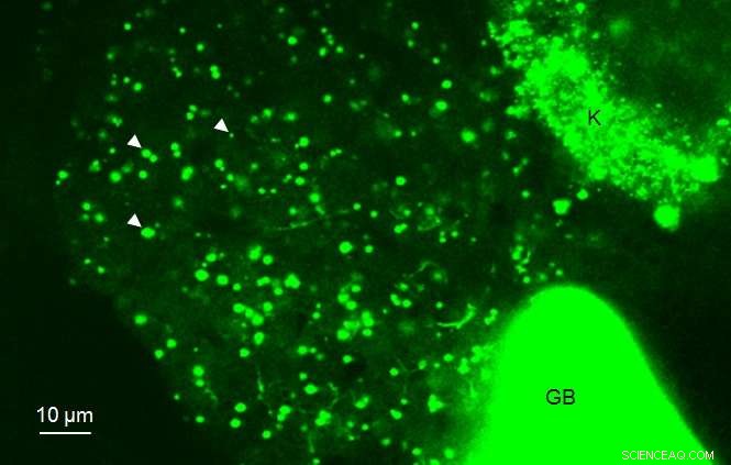 Scientists Observe Real‑Time Fat Metabolism in Live Zebrafish Livers
