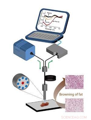 Light Imaging Reveals Distinct Fat Tissue Characteristics for Easy Detection
