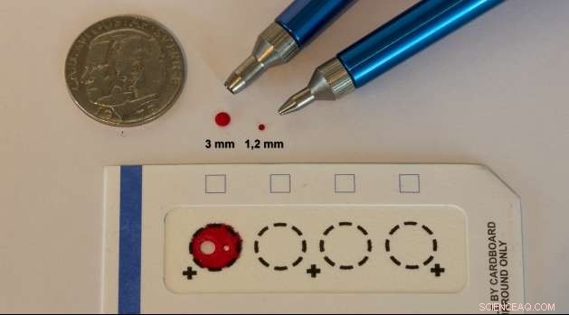 Revolutionizing Healthcare: Affordable, Reliable Diagnostics with Dry Blood Samples