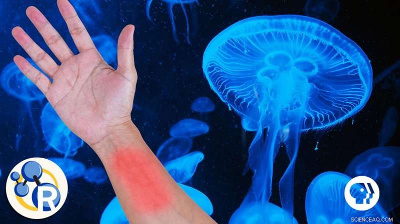 Jellyfish Sting: Is Peeing a Real Remedy? Expert Insights