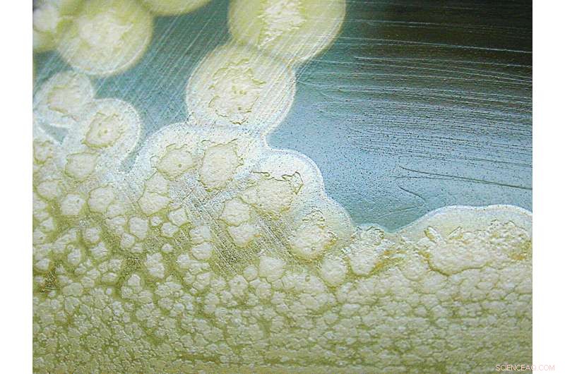 New Copper Compound Neutralizes Botulinum Neurotoxin, Offering Hope Against Poisoning