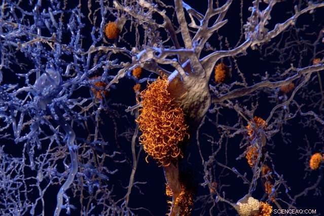 New Insights into Amyloid Metal Binding Reveal Key Protein Functions