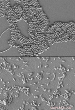 Innovative Synthetic Molecules Target Fungal Keratitis Effectively