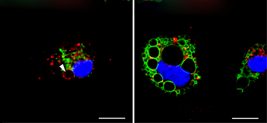 Investigating Pore Dynamics in Membrane Vesicles