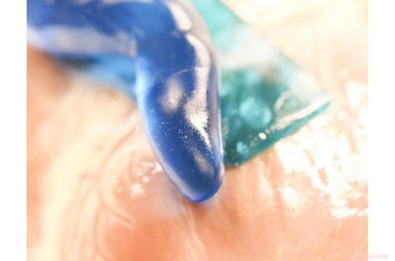 Water‑Resistant Slug‑Inspired Adhesive Revolutionizes Wound Healing