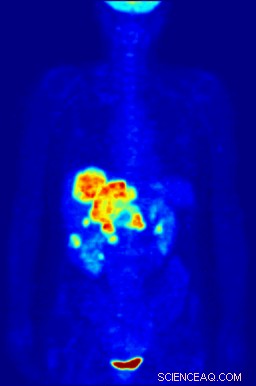 Groundbreaking PET Scan Method Reveals New Chemical Tracer Attachment Mechanism