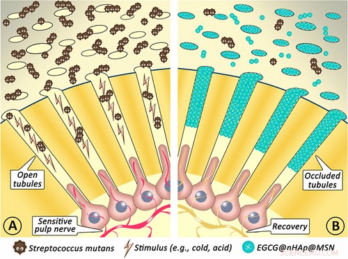 Revolutionary Treatment Promises to End Cavities for Sensitive Teeth