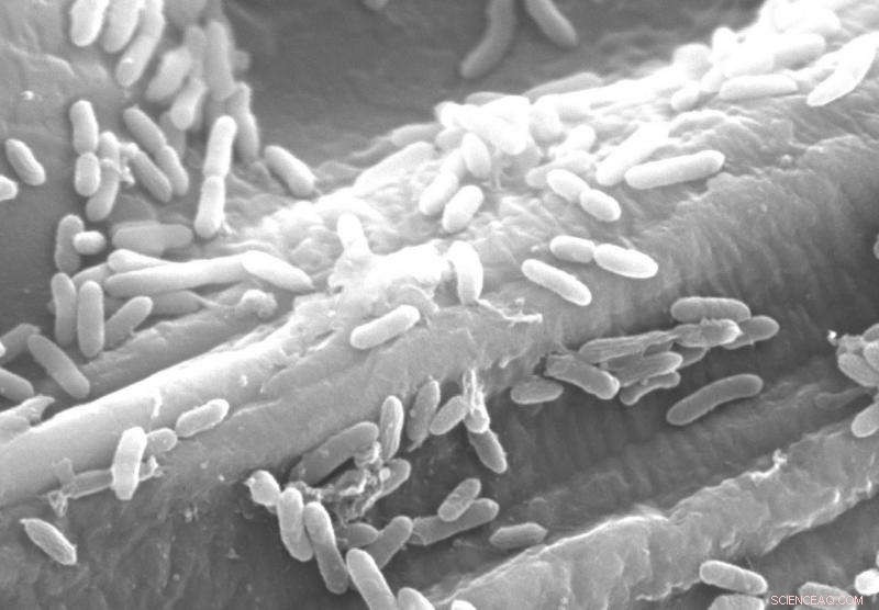 Detecting Fermentation in Bacteria that Generate Electricity