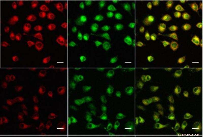 Sugar‑Coated Luminescent Probe Enhances Acid Detection in Living Cells