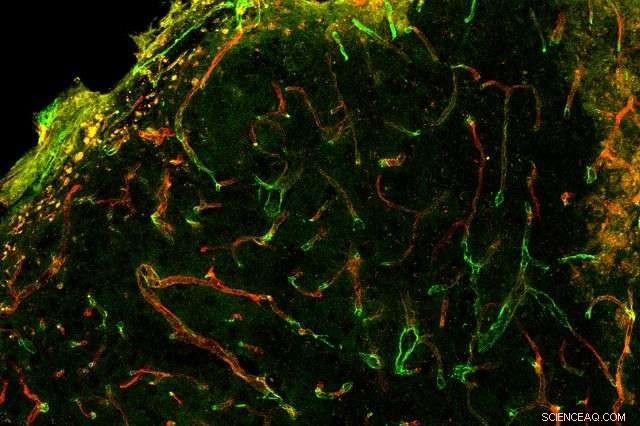 New Injectable Gel Offers Hope for Rapid Stroke Wound Healing