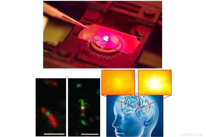 Tiny Nanosensors Unveil Brain Chemistry Secrets