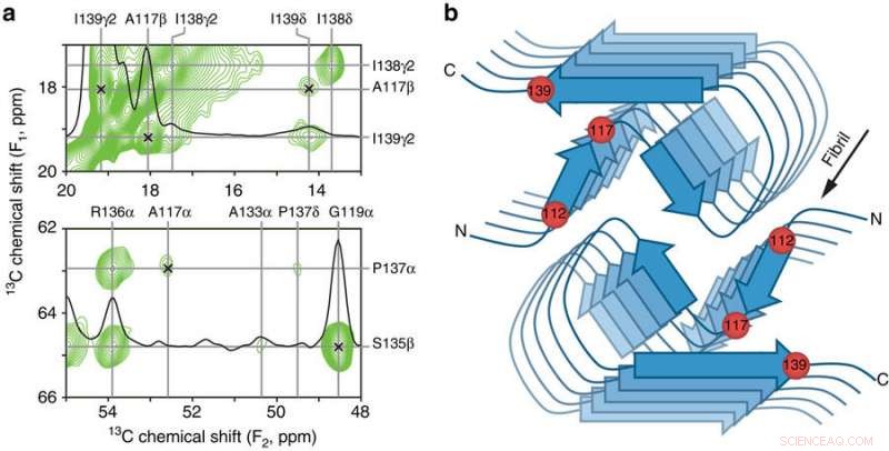Scientists Reveal Atomic-Level Structures of Proteins Linked to Brain Disorders