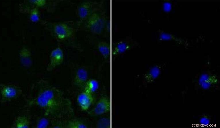 Cellular Clean‑Up Therapy Shows Promise in Eliminating Various Cancer Types