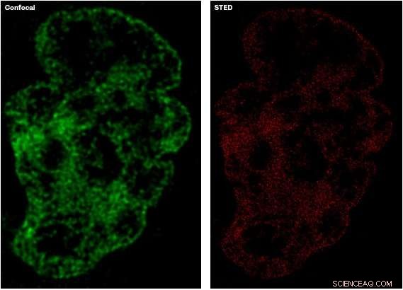 Revolutionary Super‑Resolution Probe Reveals Cells in Unprecedented Detail