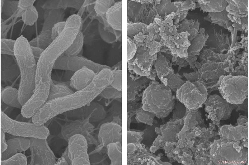 Targeted Polymer Eradicates Stomach H. pylori While Preserving Gut Microbiome