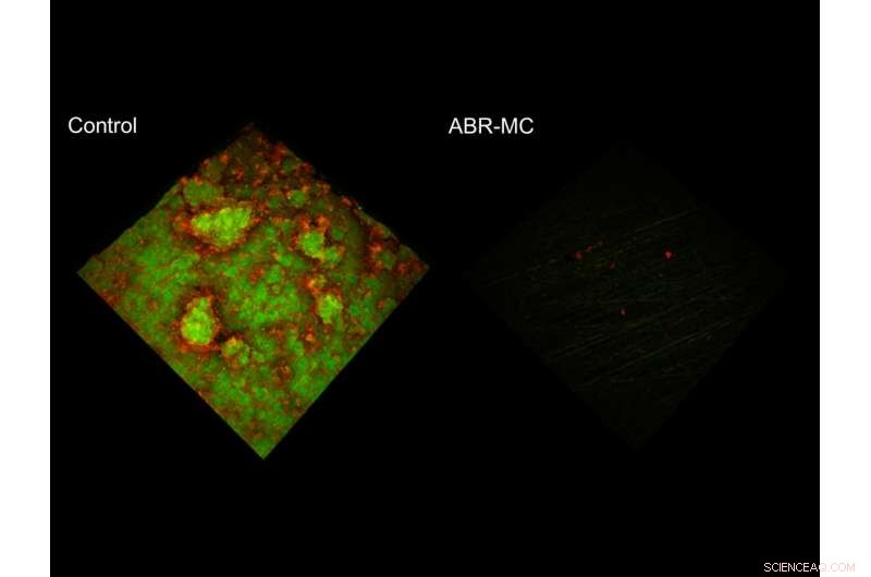 Innovative Dental Material Blocks Plaque and Eliminates Bacteria, According to Research