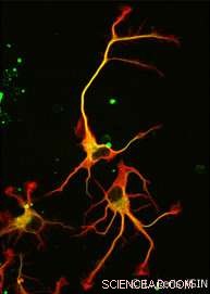 Newly Identified Enzyme Breaks Decades-Long Mystery in Tubulin Detyrosination