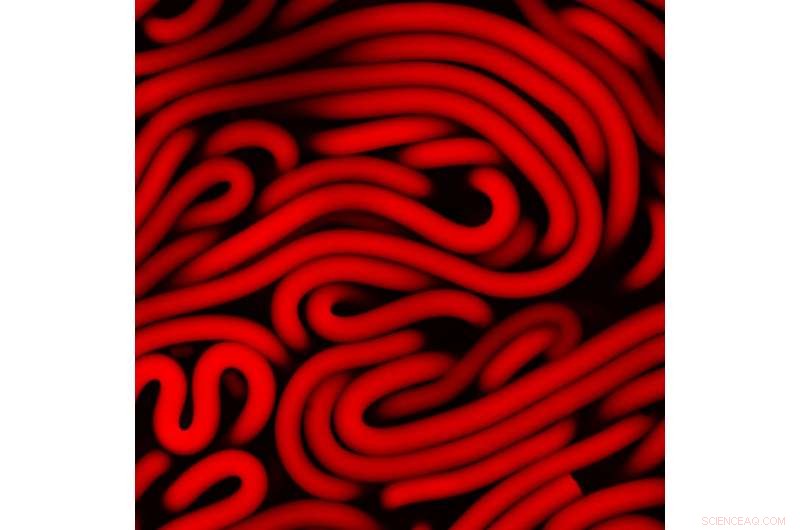 Injectable Hydrogels: Transforming Microfiber Suspensions into a Promising New Material