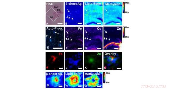 Synergistic Imaging Reveals Alzheimer’s Plaque Composition