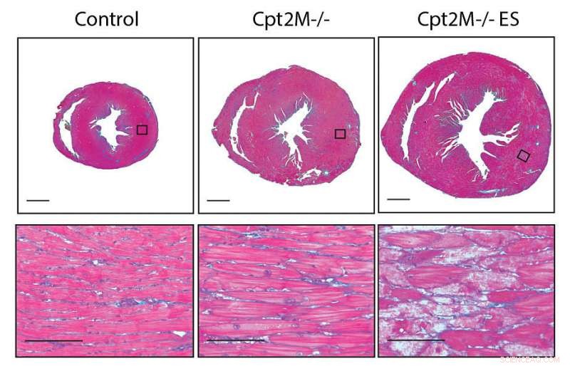 Purdue Study Shows Fat Fuel Is Key to Reversing Cardiac Hypertrophy