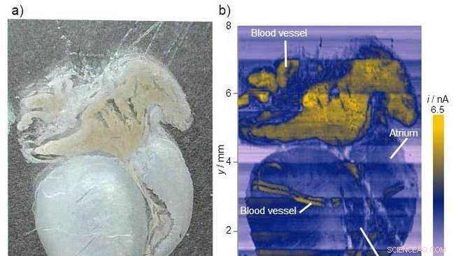 Targeting Cancer Cells with Electrochemical Imaging