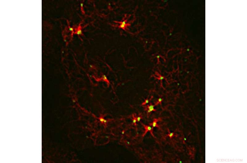 Uncovering the Cell’s Hidden Organizational Hub: Microtubule Assembly Explained