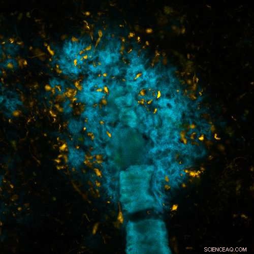 Advanced Luminescent Molecules Distinguish Brain Proteins with Precision