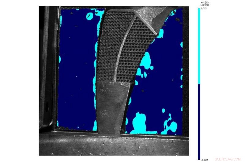 Hybrid Meta‑Biomaterial Extends Hip Implant Longevity, Researchers Show