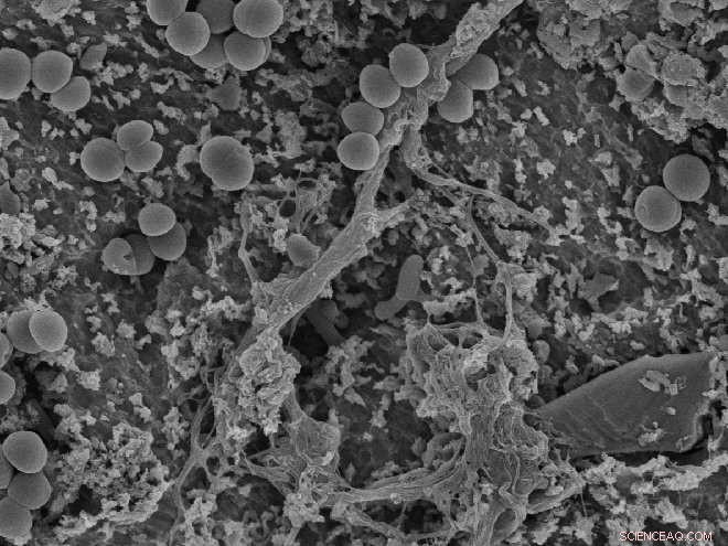 Advanced Strategies for Managing Infected Dental Implants