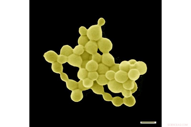 Gold‑Producing Bacteria Turn Toxic Metals Into Valuable Nuggets