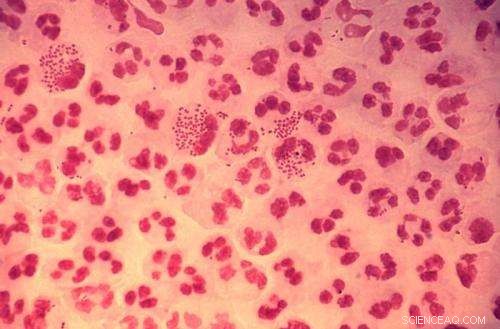 Breakthrough Research Advances Gonorrhea Vaccine Development