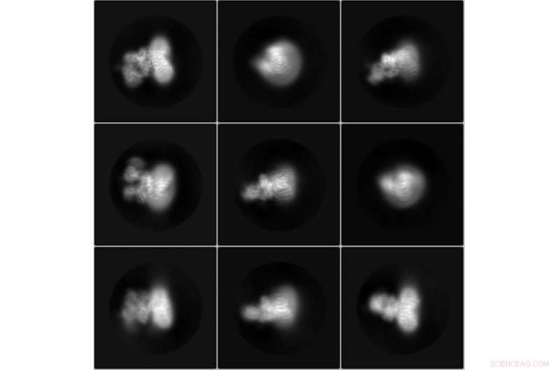 ETH Researchers Reveal 3‑D Structure of Sugar‑Attachment Enzyme