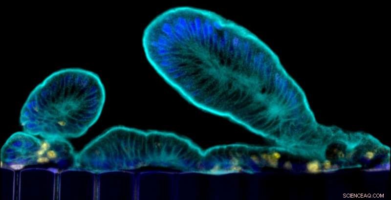 Recreating Human Gut Physiology on a Chip: From Biopsy to Complex Models