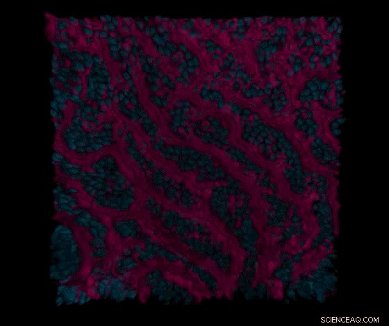 Recreating Human Gut Physiology on a Chip: From Biopsy to Complex Models