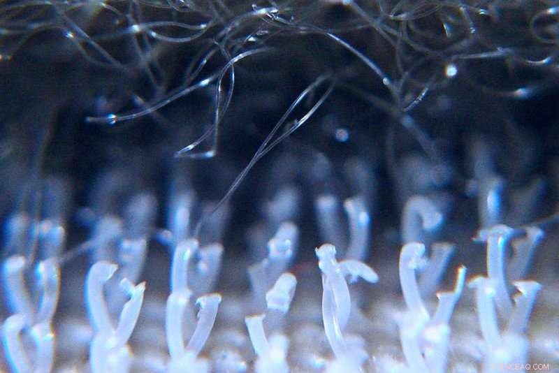 MRI Chemical Tags Bind Specifically to Target Molecules Using Velcro-Like Attachment