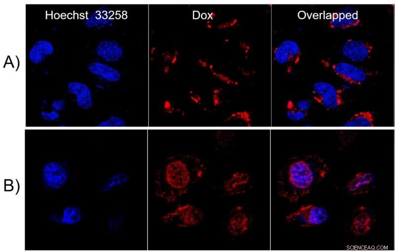 On-Demand Anticancer Drug Delivery via Laser-Triggered Vesicle Release