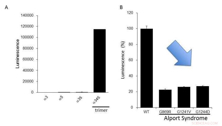 High‑Sensitivity, Multi‑Analytical Platform for Diagnosing Hereditary Kidney Disorders