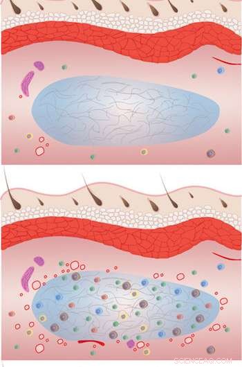 Additive-Free Hydrogel Accelerates Tissue Healing