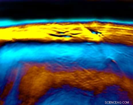 New Laser Technique Simplifies Measurement of Brown Fat Metabolic Activity