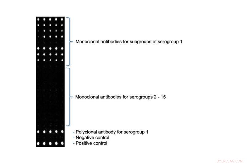 Rapid Microarray Test Accelerates Legionella pneumophila Detection in Outbreaks