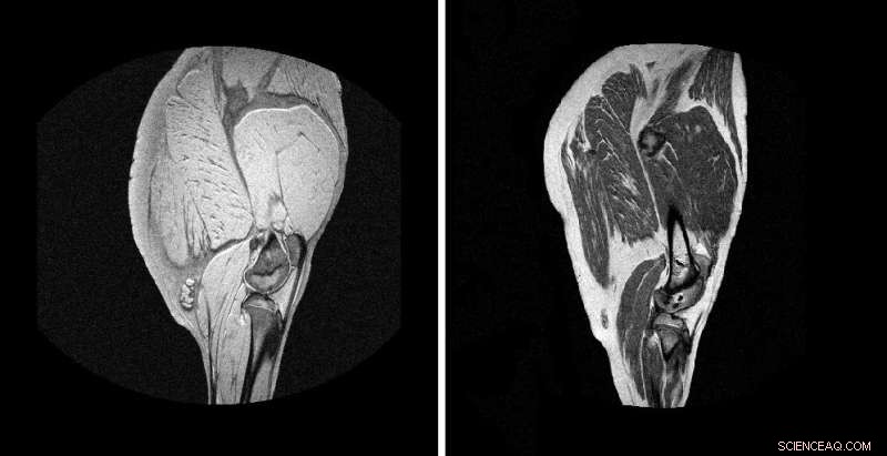 Advanced MRI Technique Reveals Quality Traits of Packaged Meats