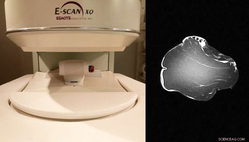Advanced MRI Technique Reveals Quality Traits of Packaged Meats