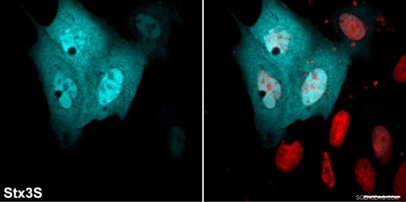 Scientists Uncover Unexpected Role of Essential Protein Class