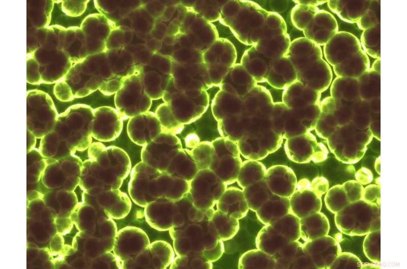 Innovative Antimicrobial Peptides Aim to Beat Drug-Resistant Bacteria