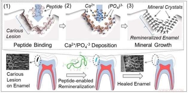 Revolutionary Peptide‑Based Dental Product Aims to Restore Enamel and Treat Cavities