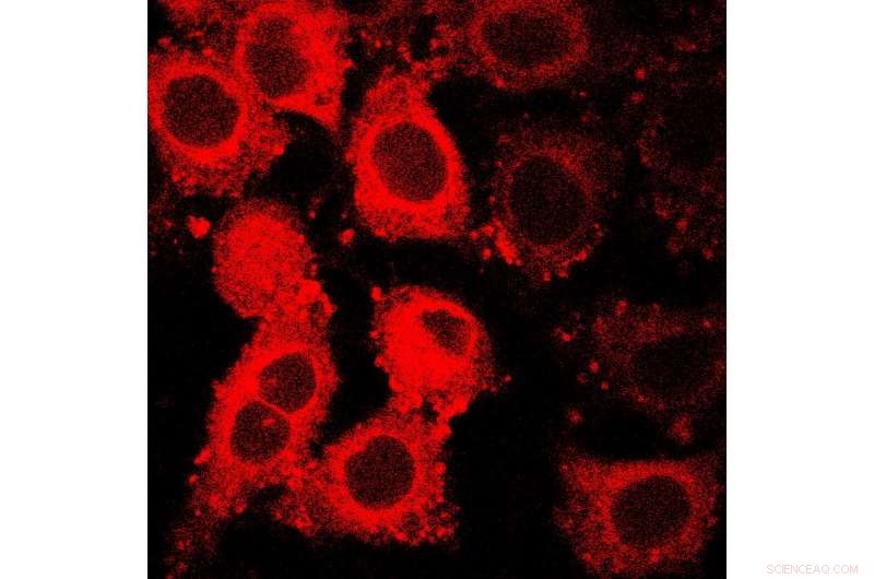 New GLUT5 Fluorescent Probe Reveals Cancer Cell Type and Aggressiveness