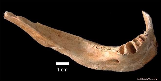 Researchers Quantify Radiation Exposure in Hiroshima Victim’s Bone Remains Using Advanced Spectroscopy